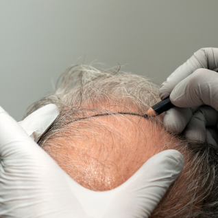 scalp assessment